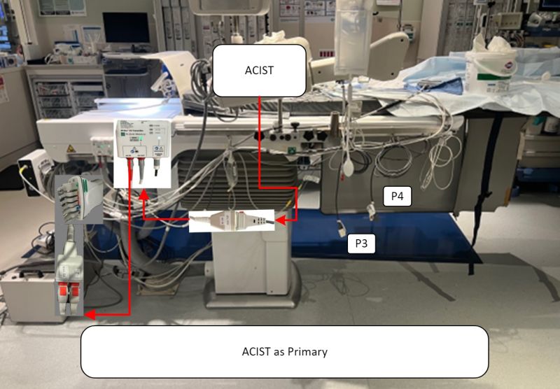 ACIST Pressure Setup for FFR