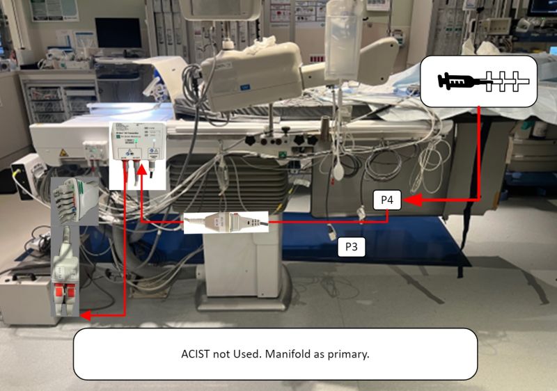 Manifold Pressure Setup for FFR